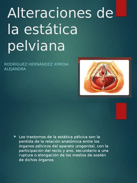 apodos para la vagina|Alteraciones de la estática pélvica .